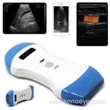 Point of Care Wireless Ultrasound Scanner